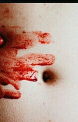 Суецидница